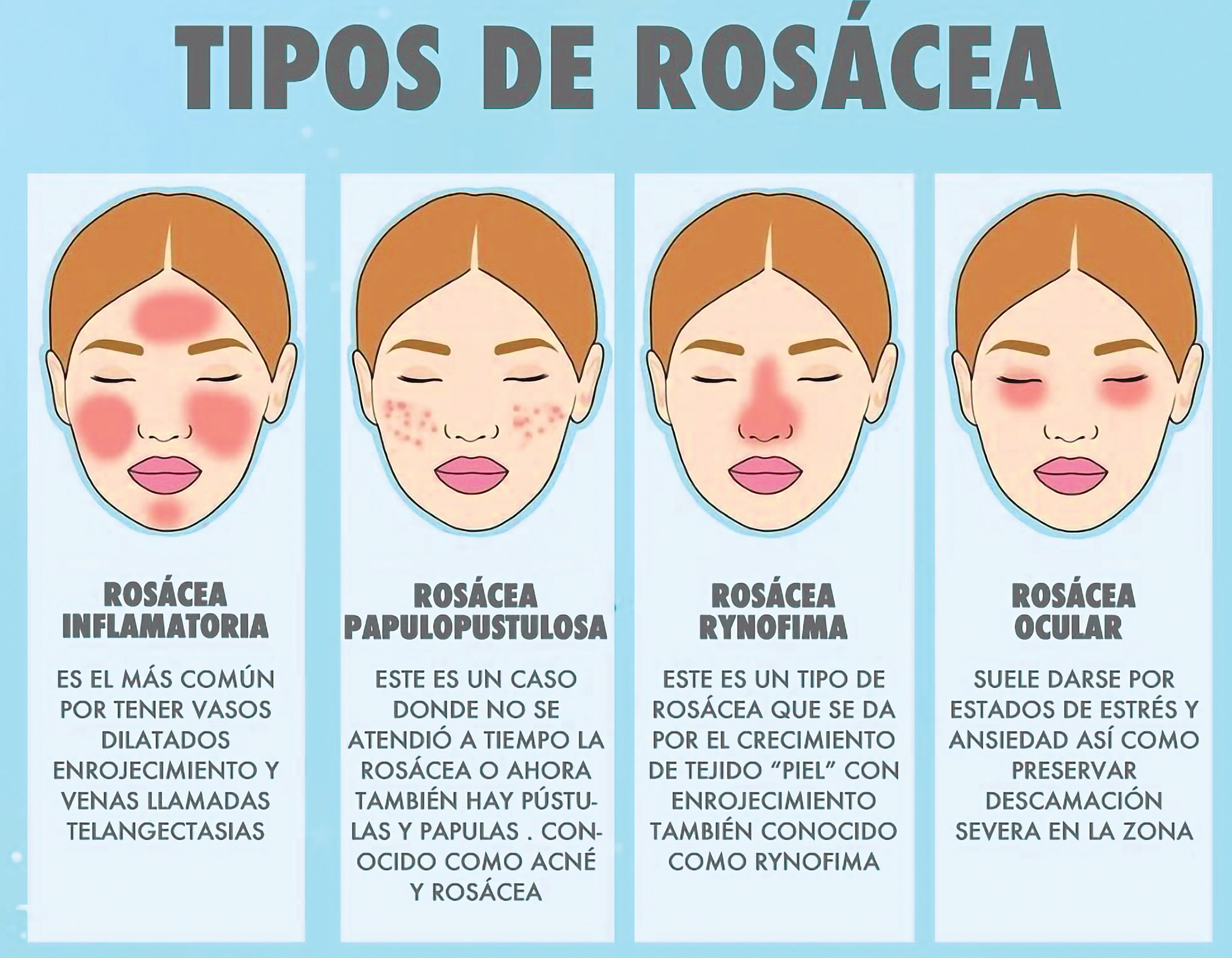 Un enemigo de tu piel ROSÁCEA 